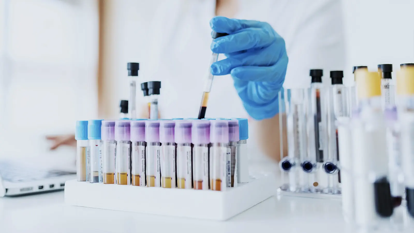 Biomarker testing